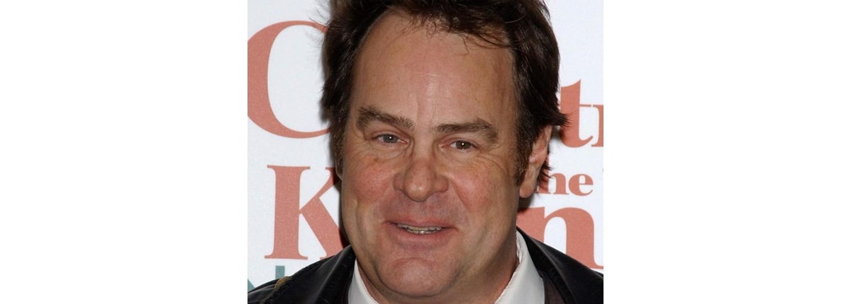 dan akroyd has heterochromia with one brown eye and one blue eye