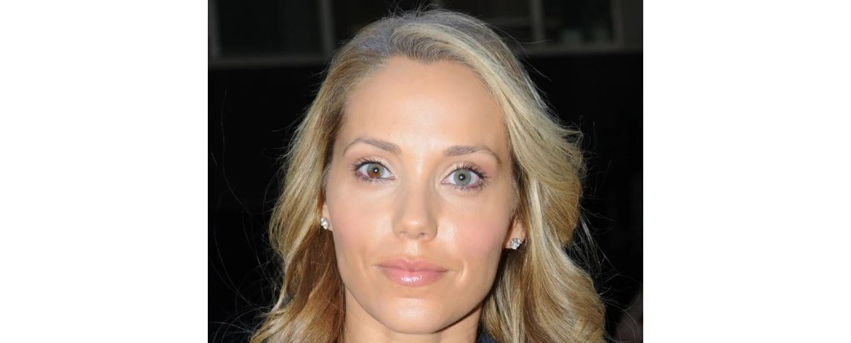 elizabeth berkley has segmental heterochromia