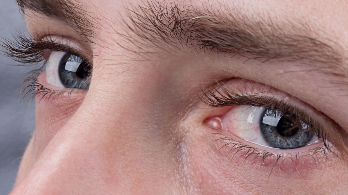 What Is the Rarest Eye Color? You Might Be Surprised