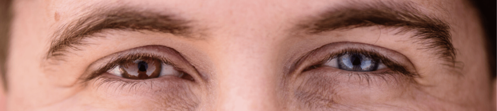 person with heterochromia