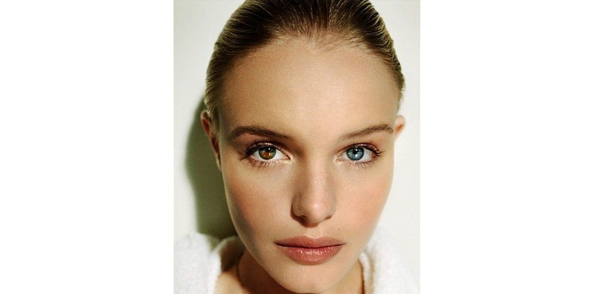 kate bosworth has segmental heterochromia