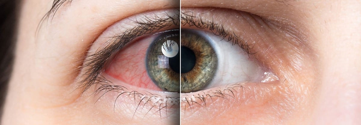 eyes wellbeing affect vision distance