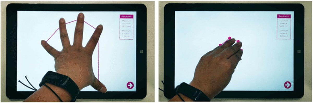 opening and closing hand in the hand assessment test