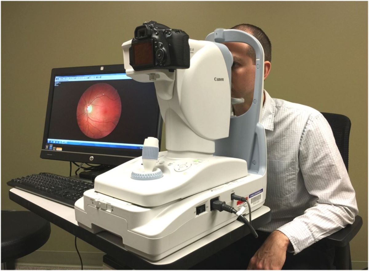 retinal camera scan eyes using laser