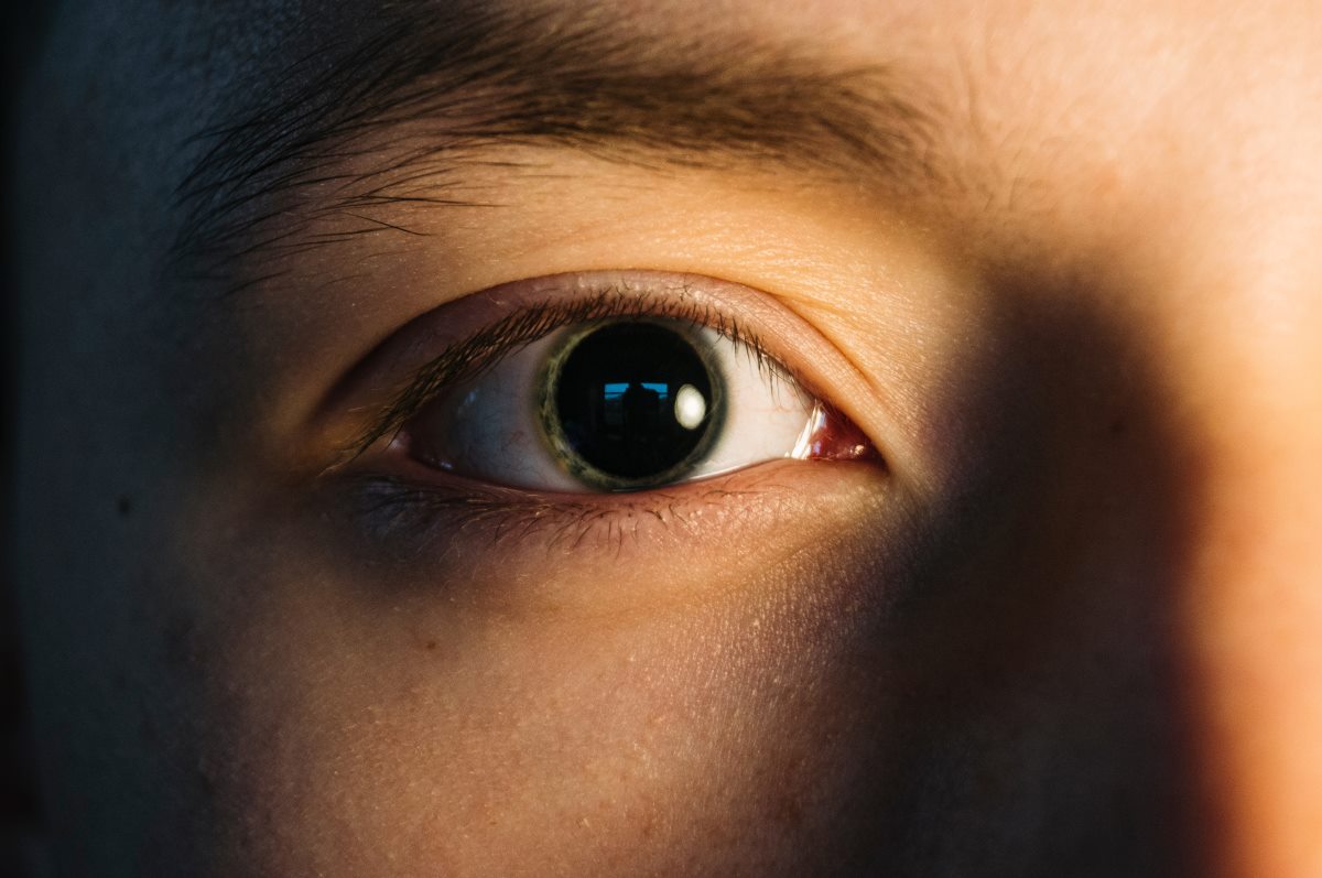 a severely dilated pupil in a human eye