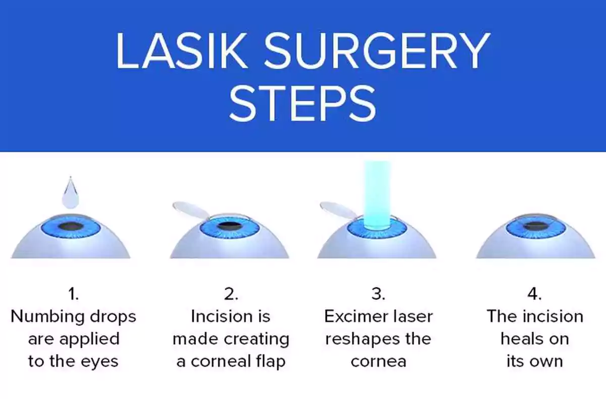 step by step illustration of lasik eye surgery